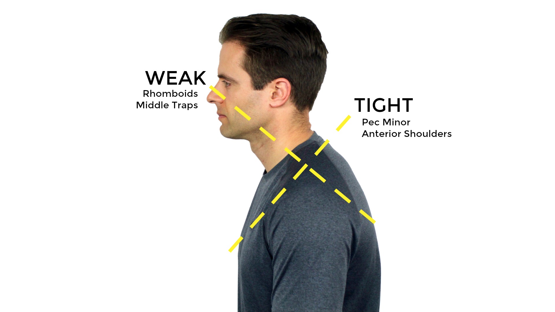 How to correct poor posture | #site_title