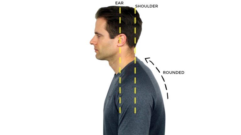 How to correct poor posture | #site_title