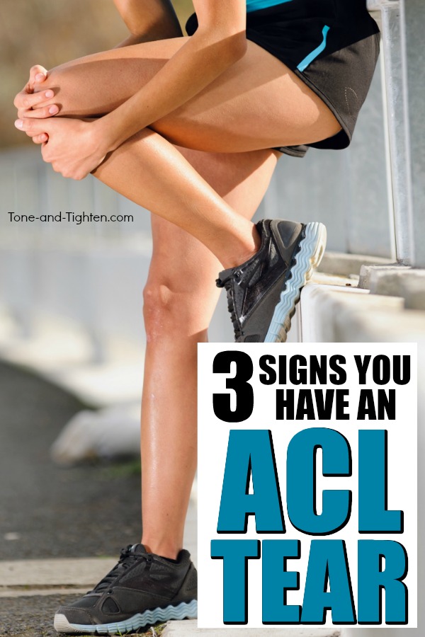 How To Check Your ACL – Top 3 Signs You Have An ACL Tear